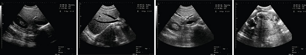 V-218全數(shù)字筆記本式動物超聲診斷儀(動物版)一流的數(shù)字成像技術(shù),圖像更清晰